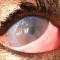Grote ulcer Engelse Bulldog
