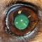 Lens na phacoemulsificatie en IOL
